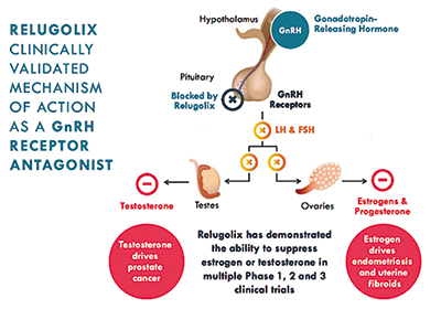 晚期前列腺癌 Relugolix睾酮去势优于亮丙瑞林